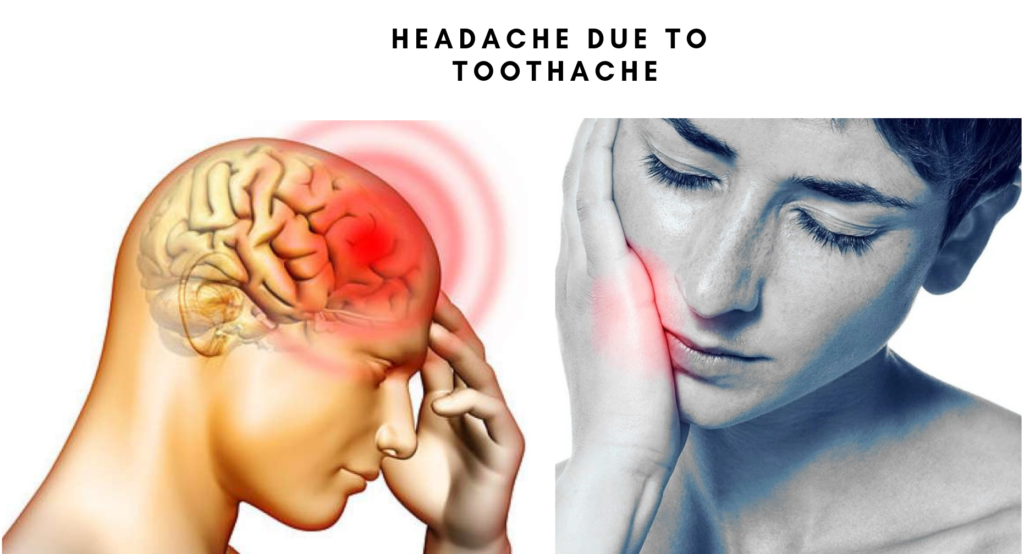 One Side Headache Due To Toothache